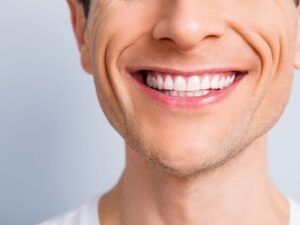 apparecchio Invisalign Milano